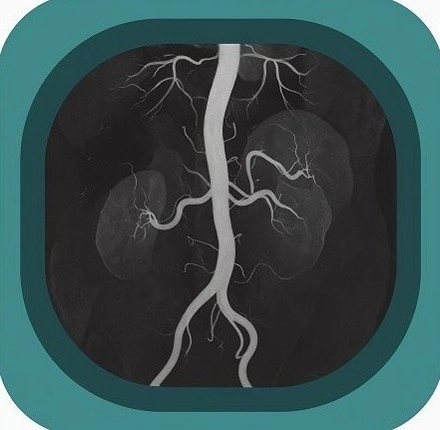 MRA abdomen anatomy icon